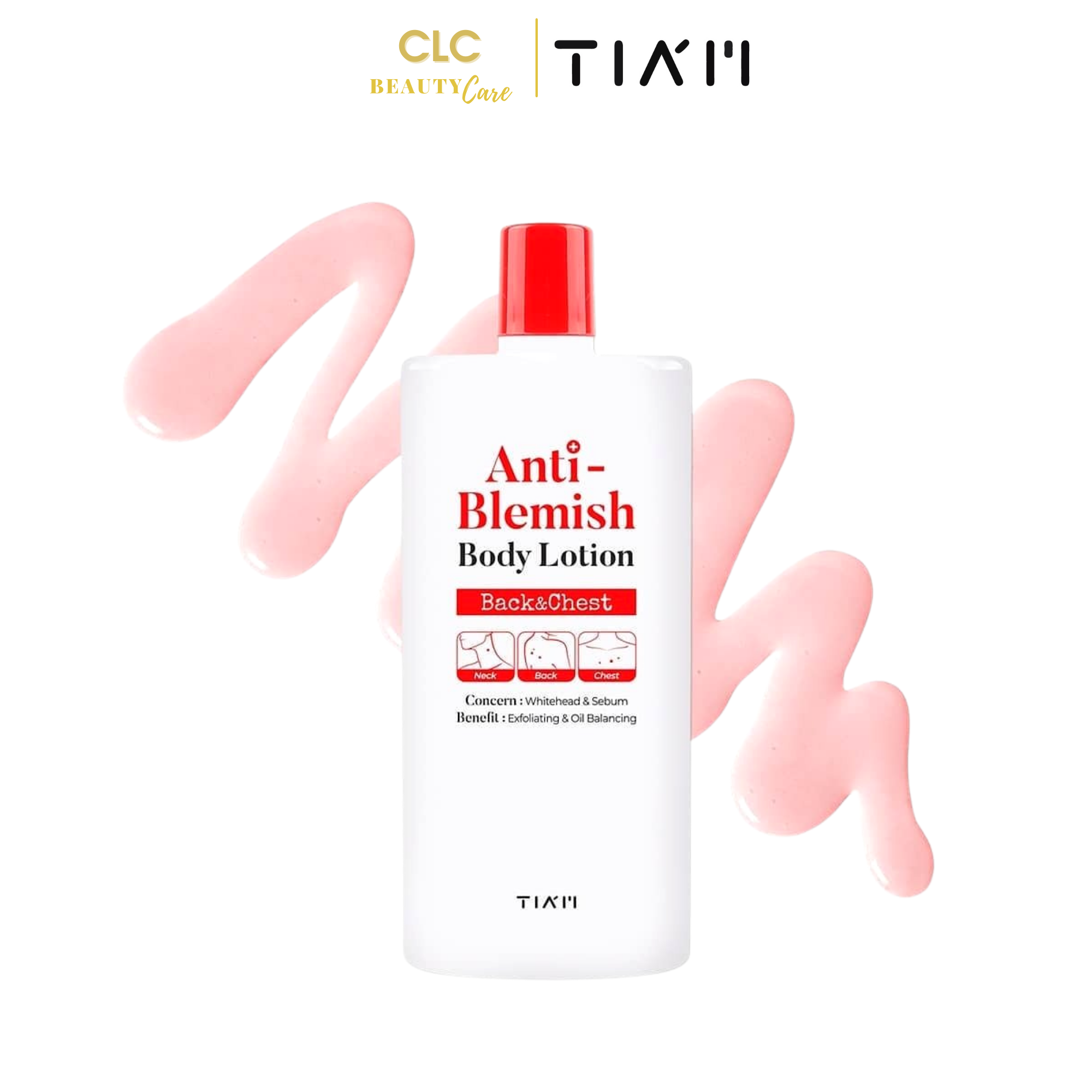 Sữa dưỡng thể chăm sóc da mụn, dưỡng trắng Tiam Anti-Blemish Body Lotion (Ngực và Lưng) 200ml