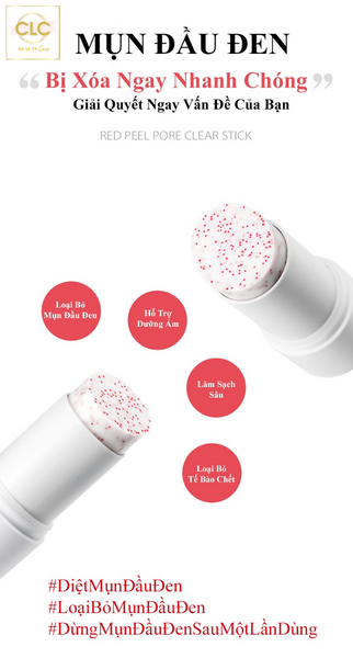 Thanh Lăn Trị Mụn Đầu Đen Hàn Quốc So'Natural Red Peel Clear Stick Blackhead & Face Clear Pore Stick 23g